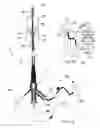 Fig. 02 - SYSTEMS AND METHODS FOR ANALYSIS AND TREATMENT OF A BODY LUMEN
