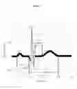 Fig. 02 - Automated Cardiac Status Determination System