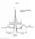 Fig. 06 - Automated Cardiac Status Determination System
