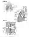 Fig. 02 - Methods and devices for assessment of pneumostoma function