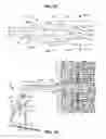 Fig. 16 - Methods and devices for assessment of pneumostoma function
