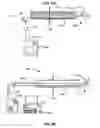 Fig. 22 - Methods and devices for assessment of pneumostoma function