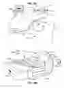 Fig. 23 - Methods and devices for assessment of pneumostoma function