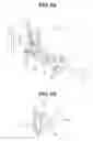 Fig. 06 - MASSAGE APPARATUS