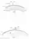 Fig. 05 - Device for Treating Hardened Lesions and Method of Use Thereof