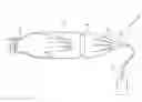 Fig. 01 - Gas mist pressure bath device
