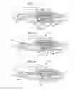 Fig. 04 - Disposable infusion device with resettable last dose lock-out