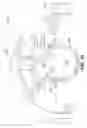 Fig. 28 - Universal safety syringe