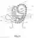 Fig. 22 - Precision Lid Retracting Eyedropper Device