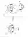 Fig. 02 - Implantable device fastening system