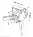 Fig. 06 - Implantable device fastening system