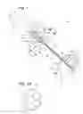 Fig. 02 - Targeted drug delivery device and method