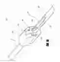 Fig. 02 - Inventory sparing catheter systems and methods
