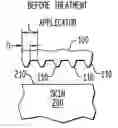 Fig. 01 - METHOD AND APPARATUS FOR TREATMENT OF TISSUE