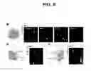 Fig. 09 - Systems, devices and methods for imaging and surgery