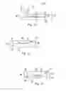 Fig. 08 - BONE RESECTION APPARATUS AND METHOD FOR KNEE SURGERY
