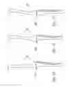 Fig. 09 - BONE RESECTION APPARATUS AND METHOD FOR KNEE SURGERY