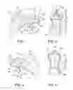 Fig. 02 - Patient specific alignment guide for a proximal femur