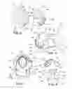 Fig. 04 - Patient specific alignment guide for a proximal femur