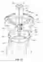 Fig. 08 - Patient specific alignment guide for a proximal femur