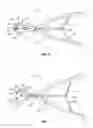 Fig. 06 - DISTRACTION TOOL FOR DISTRACTING AN INTERSPINOUS SPACE