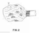 Fig. 03 - Method kit for treating bony defects