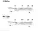 Fig. 08 - INTRAOCULAR LENS INSERTION DEVICE