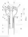 Fig. 02 - Device and method for fragmenting and removing concretions from body ducts and cavities