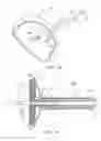 Fig. 07 - Method and apparatus for anastomosis including an expandable anchor