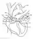 Fig. 01 - Devices, systems, and methods for percutaneous trans-septal left atrial appendage occlusion
