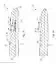 Fig. 02 - Valvulotome device and method