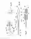 Fig. 09 - Vessel treatment devices