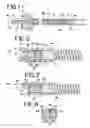 Fig. 02 - Chemically based vascular occlusion device deployment