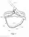 Fig. 09 - Tourniquet system