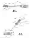 Fig. 02 - Tissue puncture closure device with actuatable automatic spool driven compaction system