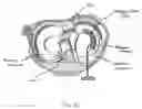 Fig. 07 - MENISCAL DEVICE