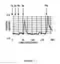 Fig. 06 - Uterine electrical stimulation system and method