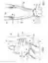 Fig. 04 - Cardiac rhythm management device with neural sensor