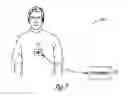 Fig. 07 - Cardiac rhythm management device with neural sensor