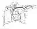 Fig. 01 - Application of electric fields to the lung as therapy for pulmonary edema