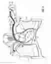 Fig. 07 - Application of electric fields to the lung as therapy for pulmonary edema