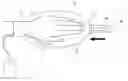 Fig. 01 - Gas mist pressure bath device