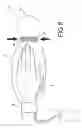 Fig. 07 - Gas mist pressure bath device