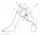 Fig. 01 - GAS MIST PRESSURE BATH DEVICE