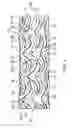 Fig. 02 - Vascular stent with composite structure for magnetic resonance imaging capabilities