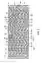 Fig. 04 - Vascular stent with composite structure for magnetic resonance imaging capabilities