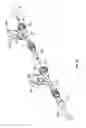 Fig. 22 - Delivery and retrieval systems for collapsible/expandable prosthetic heart valves
