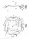 Fig. 02 - Flexible intraocular implant with circular haptic