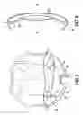 Fig. 03 - Flexible intraocular implant with circular haptic
