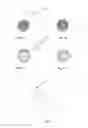 Fig. 04 - Manufacturing method of foldable artificial vitreous body and mould thereof